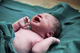 تولد نخستین کودک به روش لنفوسیت تراپی در مرکز درمان ناباروری قفقاز اردبیل