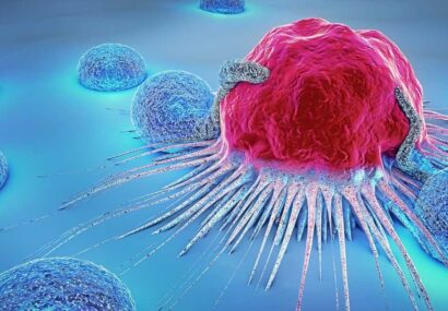 از هر ۱۰ نفر مبتلا به سرطان سینه 7 نفر درمان میشوند از هر ۱۰ نفر مبتلا به سرطان سینه ۷ نفر درمان میشوند